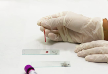 Krvni nalaz koji otkriva rizik za srce