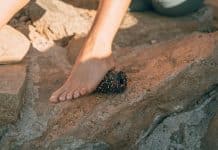 Suhe i ispucale pete